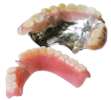 当院で作る入れ歯の特徴