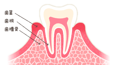歯周病初期<